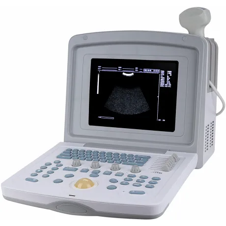 УЗИ сканер Med-Mos CMS600B3 Код товара: 00793